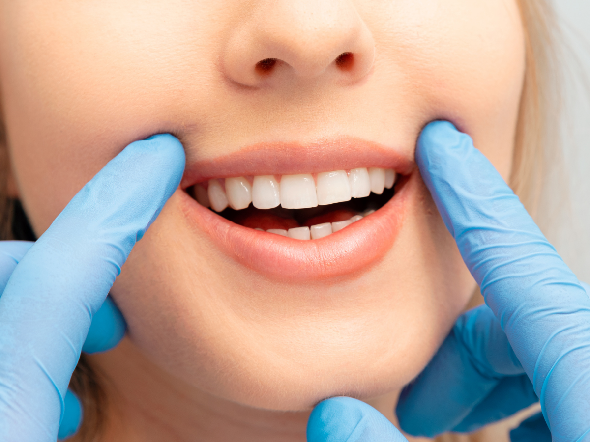 Close-up of a patient’s bright smile being examined by a dental professional after a teeth whitening treatment.