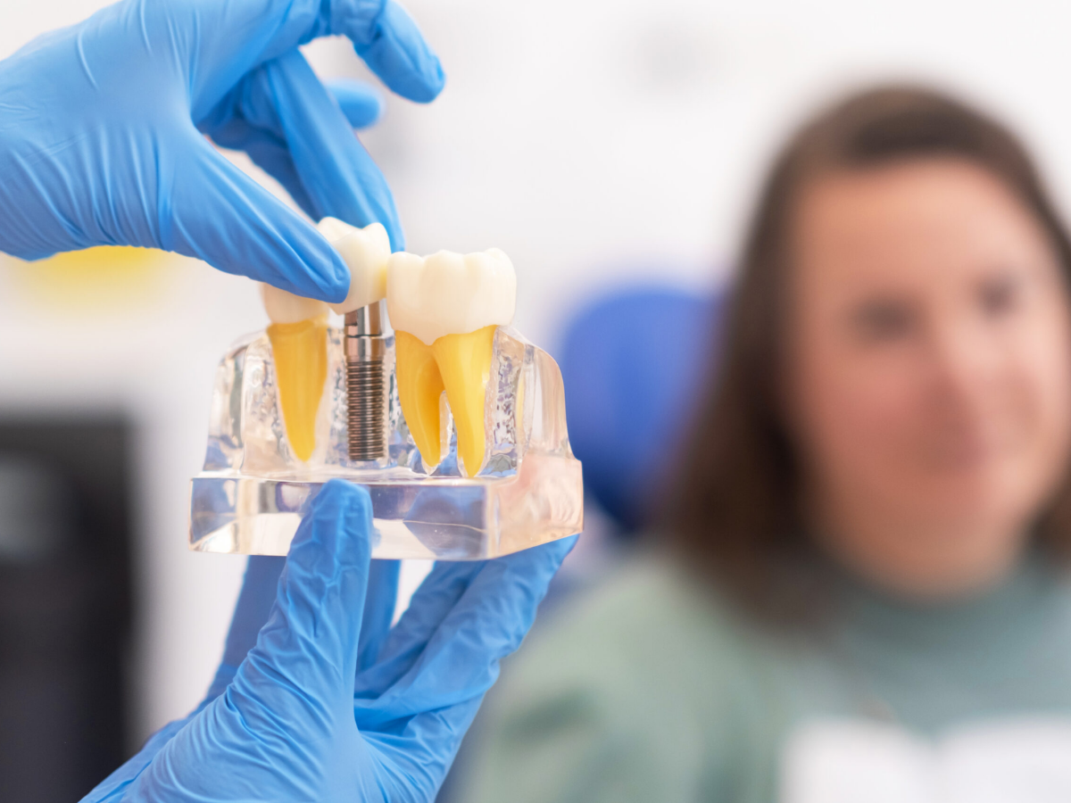 Dentist showing a dental implant model to a patient, explaining how modern techniques make implant surgery more comfortable.
