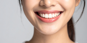 Close up of healthy smile after crowns and bridges esperance treatment