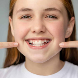 child showing crowded front teeth before orthodontic treatment